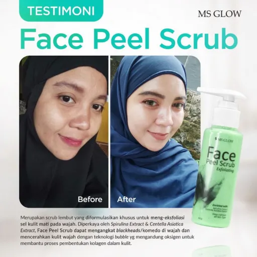 MS Glow Face Peel Scrub