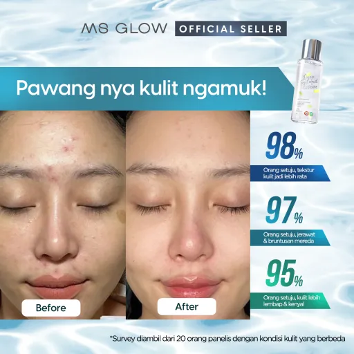 MS Glow Deep Treatment Essence